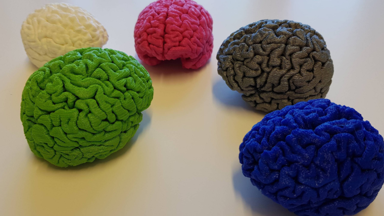 Photograph of 5 different coloured brain models - green, white, red, grey and blue